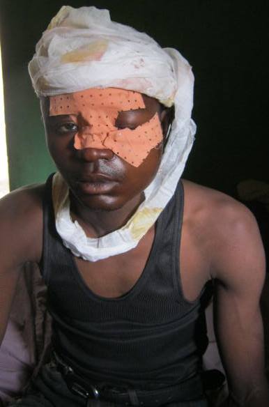 In April last year, churches were targeted by suspected Boko Haram militants. Some victims had their throats cut, while others were beaten to death or burned alive. Here is one of the survivors, whose name is being withheld to protect his security.