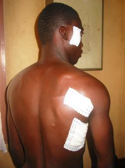 Victim of the attack on KM5, Bangui Feb 2015