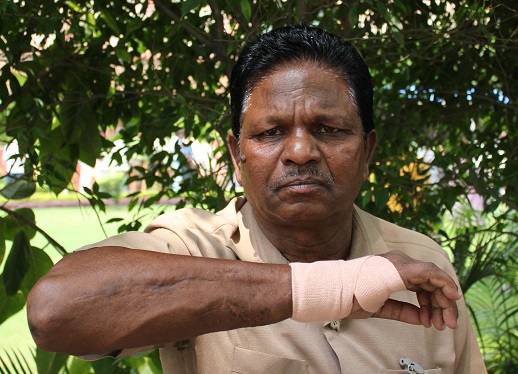 Junos Nayak, a retired policeman hurt during the Kandhamal violence. His brother, Lalji, was killed for refusing to adhere to the 30-day deadline given to the 250 Christian families of Gadaguda village to forsake their faith and embrace Hinduism. Junos was shot as he tried to flee the mob and had to undergo months of treatment.