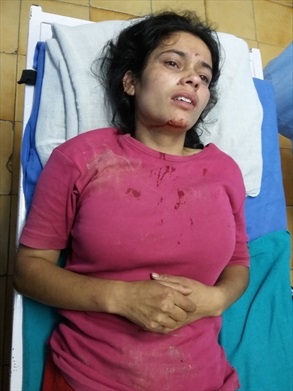 Sunita Kumar
 in hospital after the attack.
