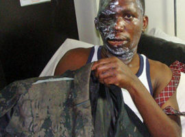 Muslim extremists in Uganda throw acid on bishop