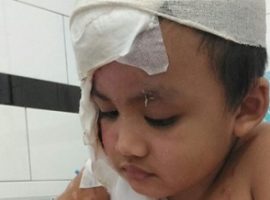 Injured Indonesian boy, 4, ‘ashamed’ by wounds after 17th operation since November church attack