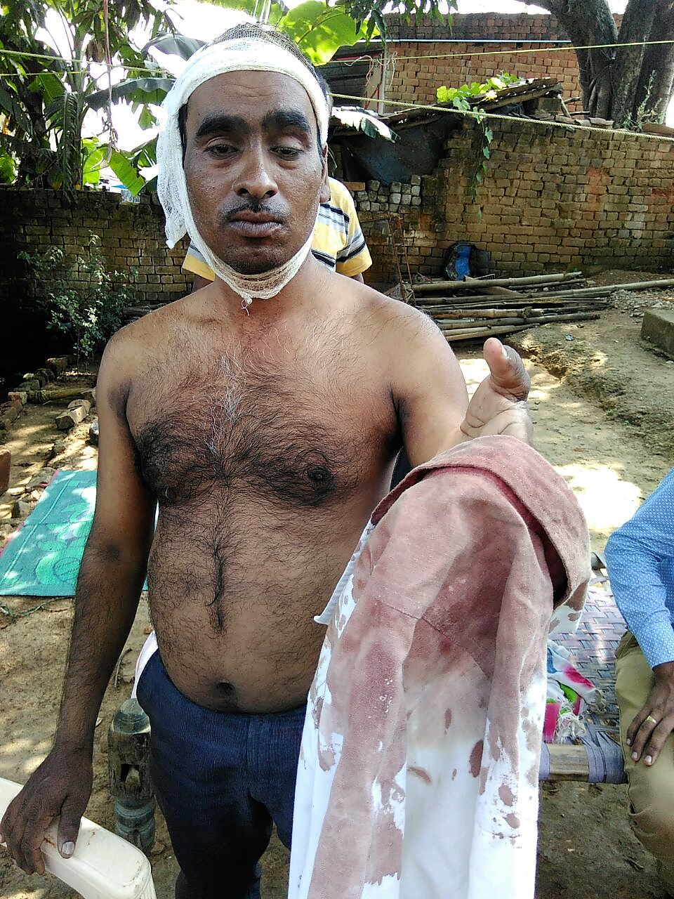 Pastor Khel Prasad Kurre after his attack