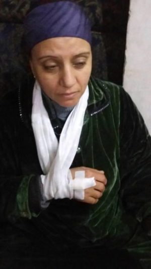 A woman got hurt in the violence in El Dawwar village. (Photo: World Watch Monitor)