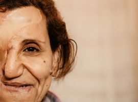 The woman who lost half her face in Cairo church attack