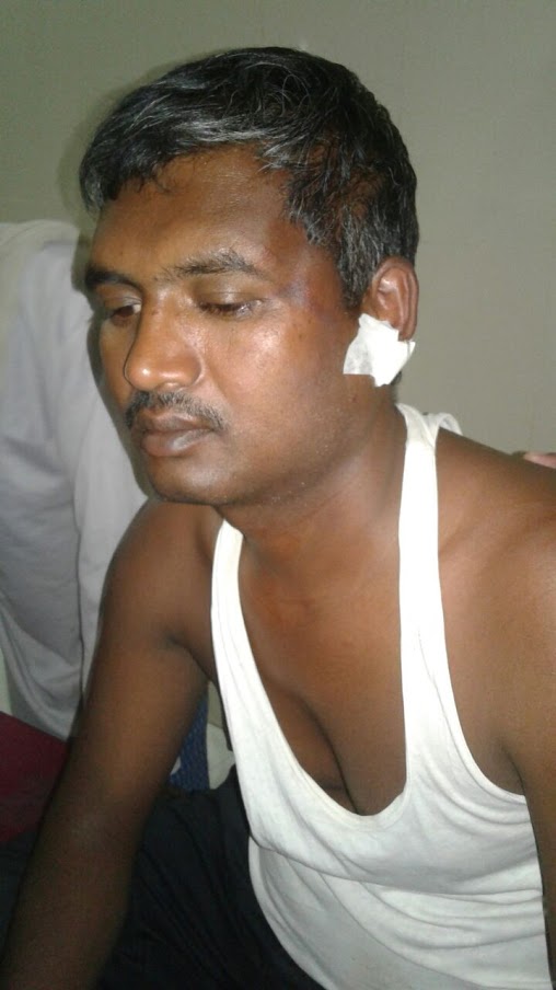 25-year-old Dinesh Kumar tried to stop the attack on his pastor (World Watch Monitor)