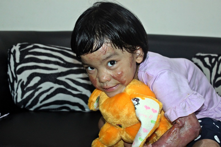 Trinity was injured in a church bomb attack in Indonesia in 2016. (World Watch Monitor)