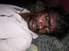 One of the victims of the attack on Christian families in Odisha that left some critically injured. (Photo: World Watch Monitor)