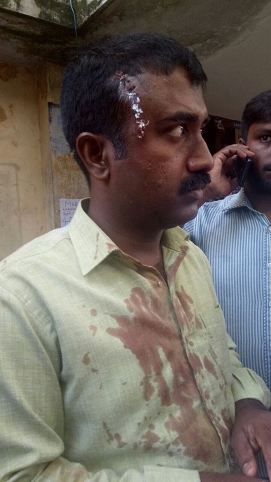 Pastor Karthik Chandran sustained injuries during the attack (World Watch Monitor)