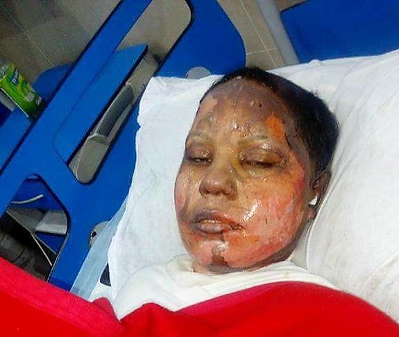 Asma Yaqoob died in hospital with 80% burns (World Watch Monitor)