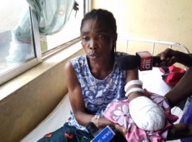 Wenhana Sheku had her left hand cut off by suspected Fulani militants, Oct 2019